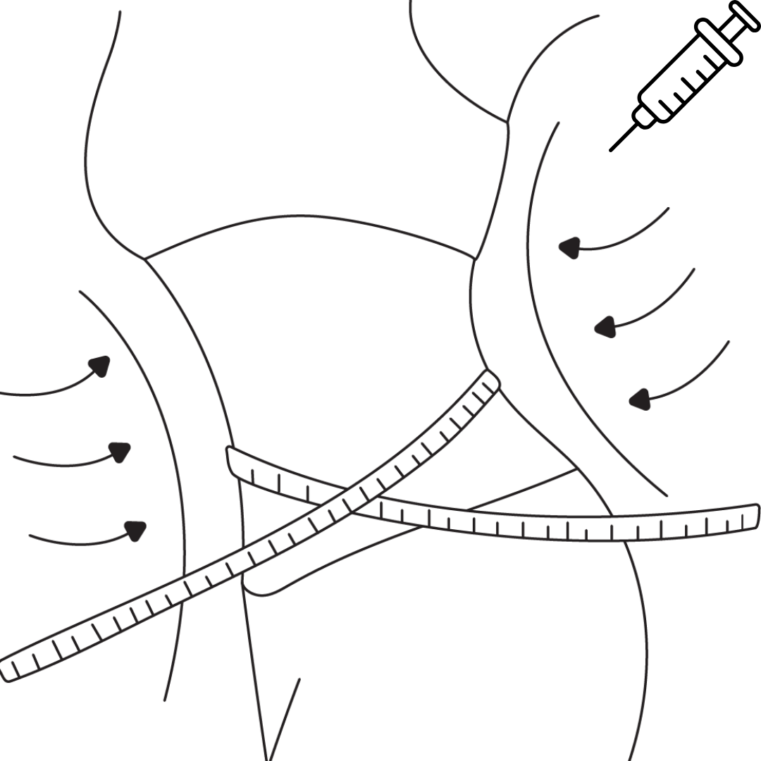 3 Woman having her waist measured during a medical weight loss assessment